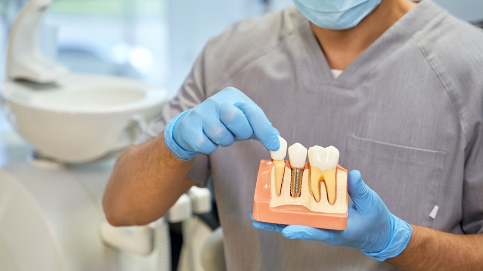 3 Reasons Why You Should Get Dental Implants