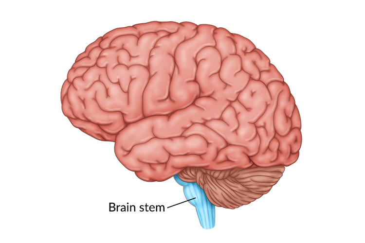 What are some brain stem disorders?   